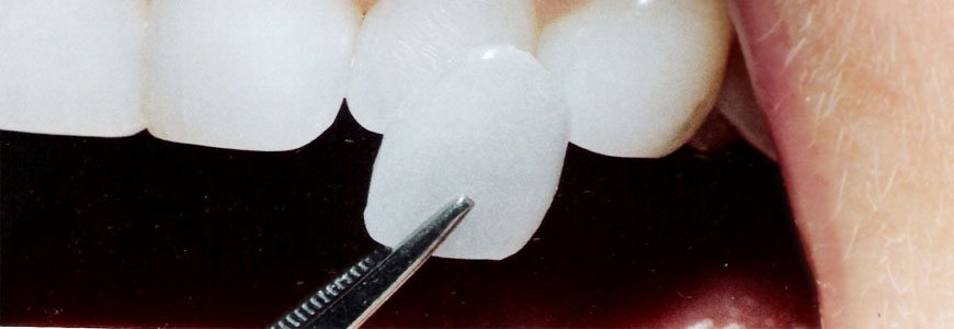 Restorative Dentistry